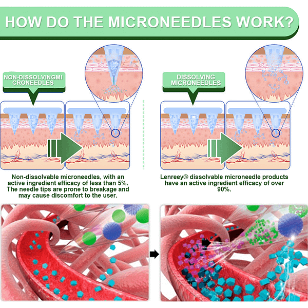 Lenreey® GIP+GLP-1 Nano Microneedle Patch