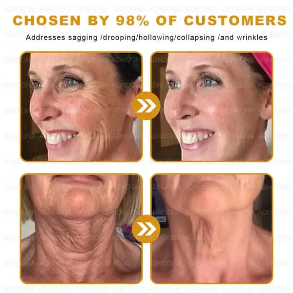 ADNOON™ Botox & Bee Venom Skin Treatment Cream