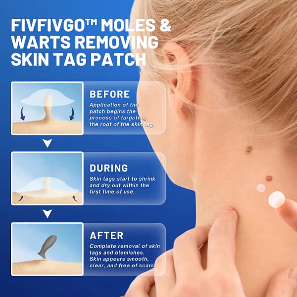 Fivfivgo™ Moles & Warts Removing Skin Tag Patch