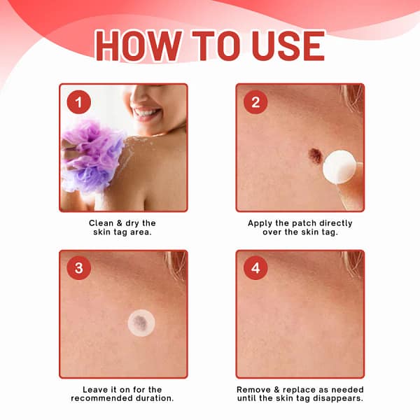 Fivfivgo® MicroDart Skin Tag Remover Patch