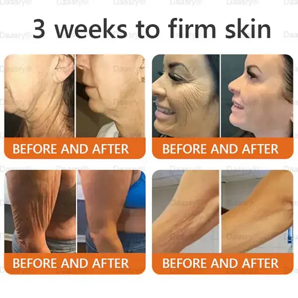 Daasry® “Dermal Gold” Botox Bee Venom Skin Restoration Cream