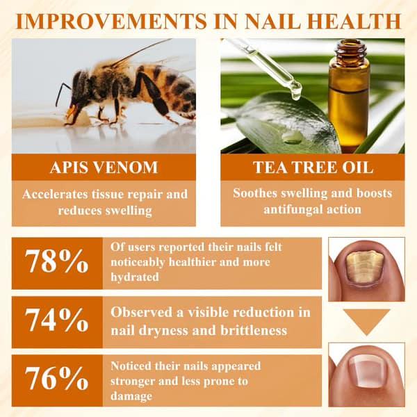 Fivfivgo® Fungiclear Bee Therapy Nail Spray