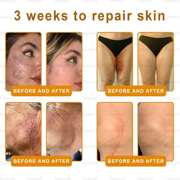 Daasry® “Dermal Gold” Botox Bee Venom Skin Restoration Cream