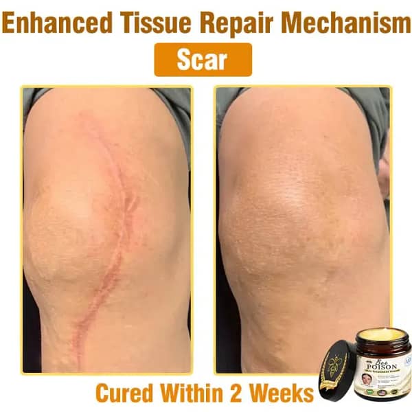LOVILDS® Full-Body Repair Cream