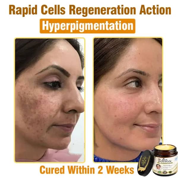 LOVILDS® Full-Body Repair Cream
