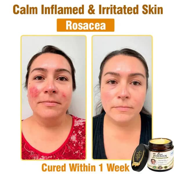 LOVILDS® Full-Body Repair Cream