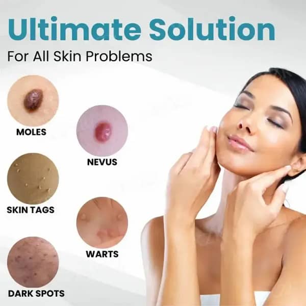 DermaZap™ Non-Invasive Mole and Wart Removal Laser Pen