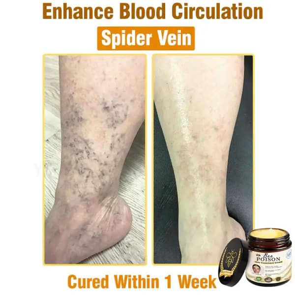 LOVILDS® Full-Body Repair Cream