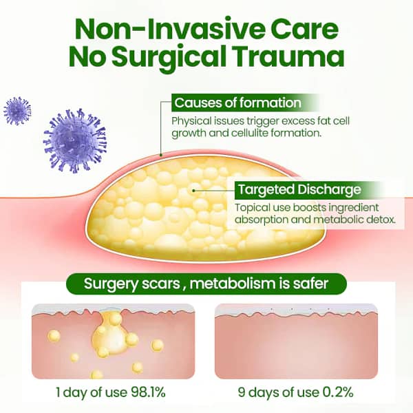 Fivfivgo® KnotAway Lipoma Removal Cream