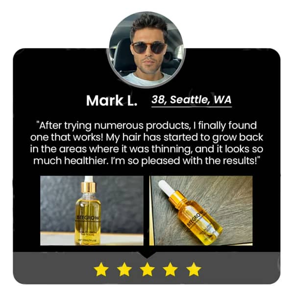 Fivfivgo™ BeeGrow Follicle Reviving Hair Essence