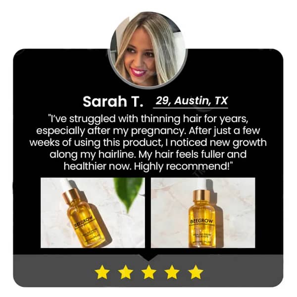 Fivfivgo™ BeeGrow Follicle Reviving Hair Essence