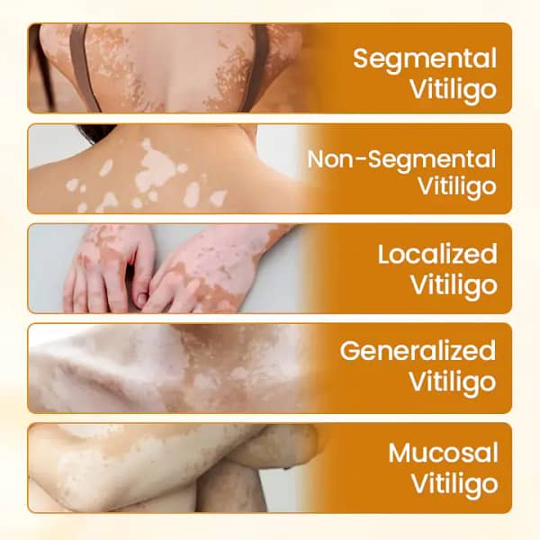 Timilk® VitiCalm Bee Venom Cream
