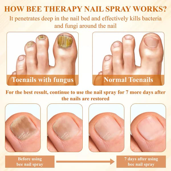 Fivfivgo® Fungiclear Bee Therapy Nail Spray