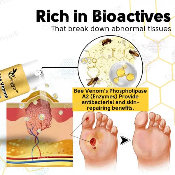 Cvreoz® Bee Venom Diabetic Foot Treatment Spray