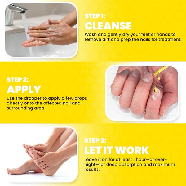 Fivfivgo® ClariNail Bee Venom Fungal Solution Drops