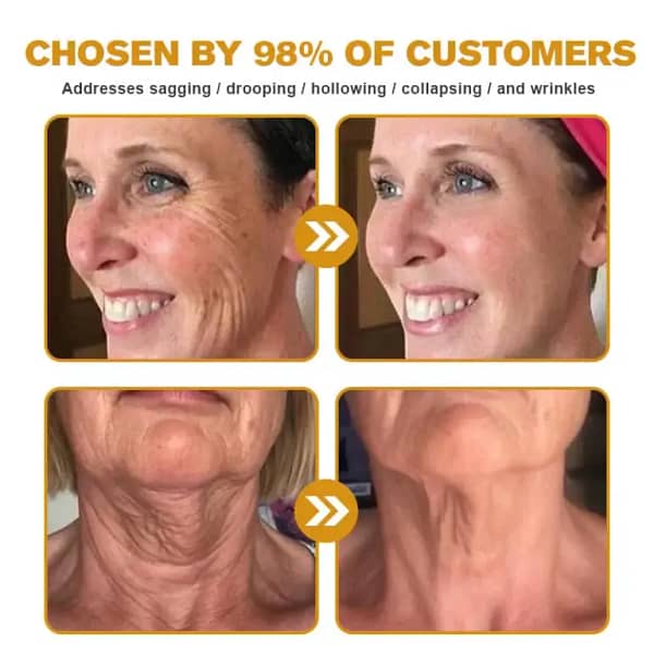 APKAPK™ Bee Venom Skin Treatment Cream