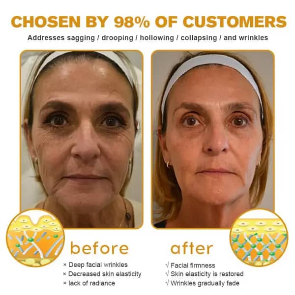 APKAPK™ Bee Venom Skin Treatment Cream