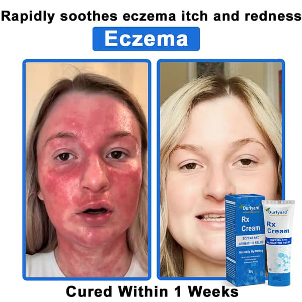 Ourlyard® OatCalm Skin Repair Cream