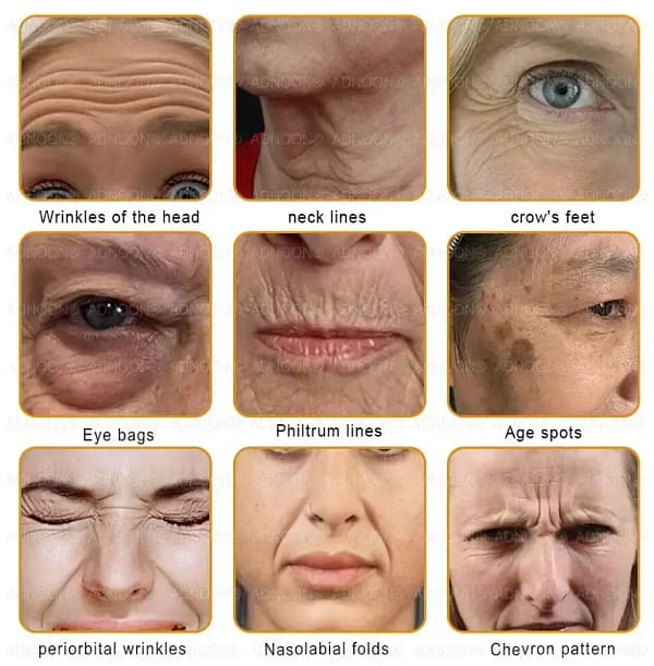 ADNOON™ Botox & Bee Venom Skin Treatment Cream