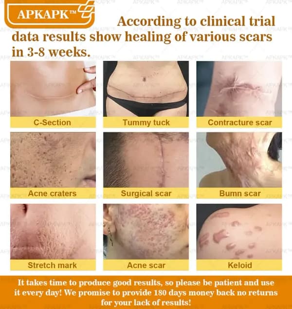 APKAPK™ Bee Venom Skin Treatment Cream