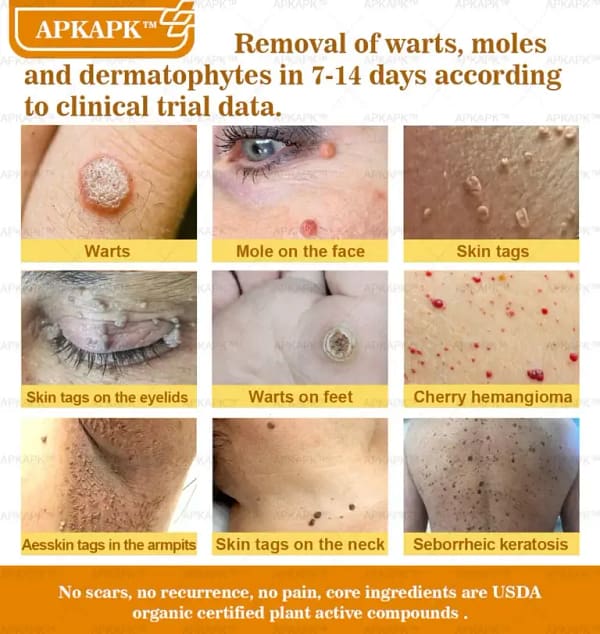 APKAPK™ Bee Venom Skin Treatment Cream
