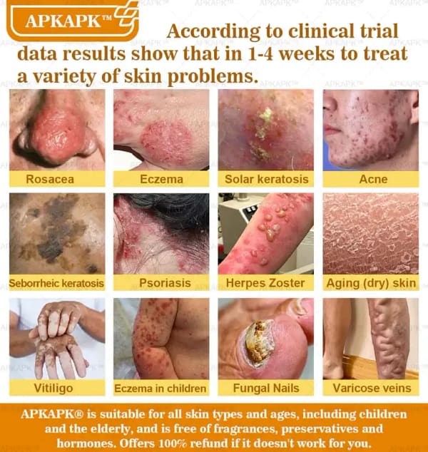 APKAPK™ Bee Venom Skin Treatment Cream