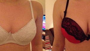 Elycura™ Nano Microneedle Breast Patch