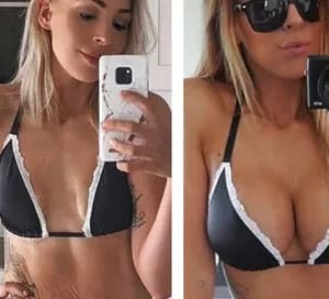 Elycura™ Nano Microneedle Breast Patch