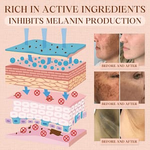 Luhaka® Purifying Exfoliating Gel for Acanthosis Nigricans