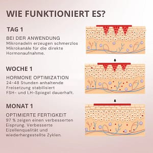 Oveallgo® FertiliPatch Mikronadeln Fruchtbarkeit Verbesserung System