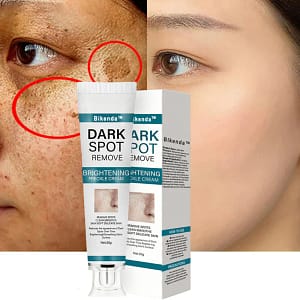 Bikenda™ Blemish Removing Beauty Cream