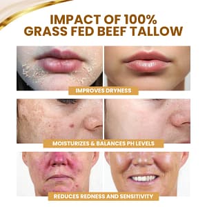 Timilk® DermSerene Beef Tallow Honey Balm
