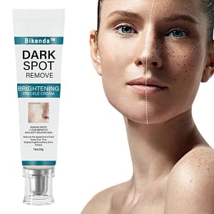 Bikenda™ Blemish Removing Beauty Cream