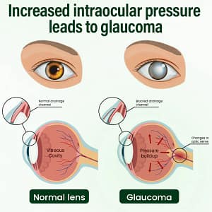 Timilk® VisionClear Nano Eye Drops