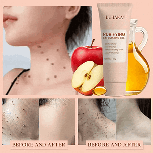 Luhaka® Purifying Exfoliating Gel for Acanthosis Nigricans