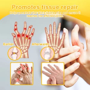 ADNOON® Botulinum Toxin & Bee Venom Pain-Relief Bone Healing Cream