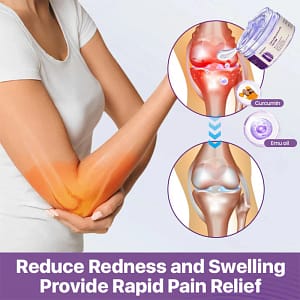 Misspone™ Curcumin & Emu Oil Pain Gel