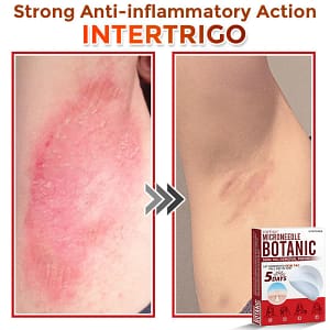 Fivfivgo® MicroNeedle Botanic Skin Tag Removal Patch