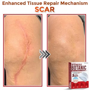Fivfivgo® MicroNeedle Botanic Skin Tag Removal Patch