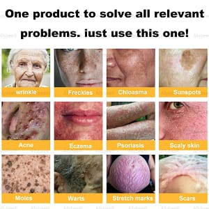 BBOJI™Bee venom Comprehensive Cream