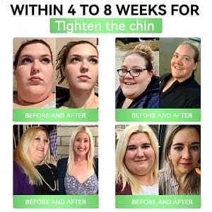 Utummy™ GLP-1 8-in-1 Slim & Healthy Oral Solution