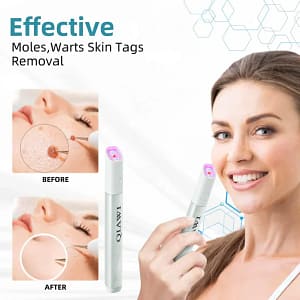 QIAWI™ All-in-One CO₂ Laser Eraser Pen