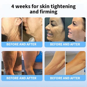 LOVILDS® Ultimate Firming & Rejuvenating Cream