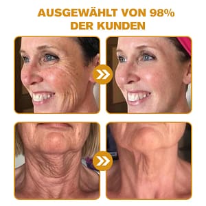 Furzero™ Botox Bee Venom Wrinkle Removal Cream