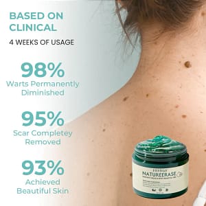 Fivfivgo® NatureErase Instant Mole & Spot Removal Gel PRO