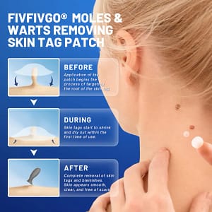 Fivfivgo® Moles & Warts Removing Skin Tag Patch