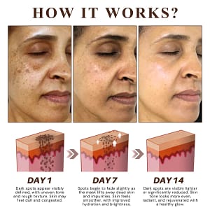 Fivfivgo® Herbal Spots Peel-Off Facial Mask