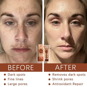 Fivfivgo® Herbal Spots Peel-Off Facial Mask