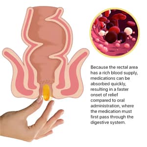 Fivfivgo® Natural Hemorrhoid Capsules