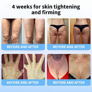 LOVILDS® Ultimate Firming & Rejuvenating Cream